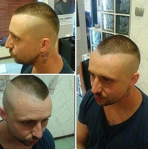 11-shaved-sides-haircut-for-men-with-thinning-hair-7948558